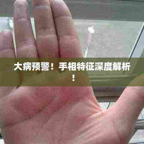 大病预警！手相特征深度解析！
